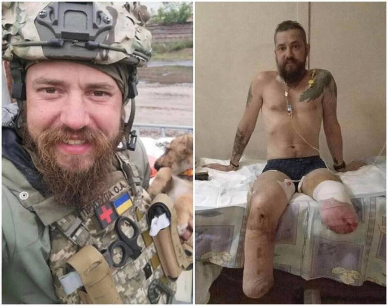 台籍乌克兰女婿Borya分享前线作战的姐夫，在光复利曼前一天遭俄军炸断双腿的照片。（粉专「我与我的乌克兰老婆Tanya」授权使用）(photo:LTN)