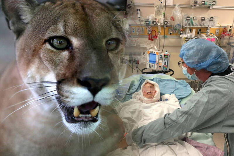 8岁男童遭美洲狮攻击，经医院抢救后成功活了下来。（欧新社、图翻摄自推特；本报合成）(photo:LTN)