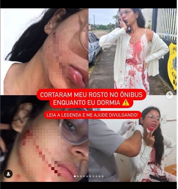 巴西网红遭陌生女子持刀攻击，血染全身。（图片撷取自IG@teffi_nh）(photo:LTN)
