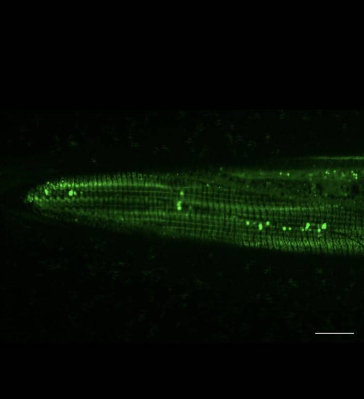 饮食限制可以增强线虫的自噬体（绿色光点）。（阳明交大提供）(photo:LTN)