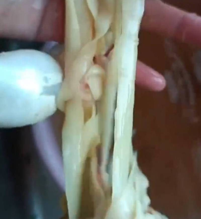噁！活魚剖腹赫見滿肚子「刀削麵」 她煮熟照吃才知是寄生蟲