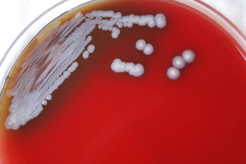 [新聞] 墨西哥灣出現致死率50％病菌 美國CDC證實