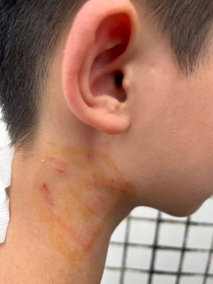 宜蘭童玩節更衣室黑衣男逞凶 少年莫名其妙被關門痛毆受傷