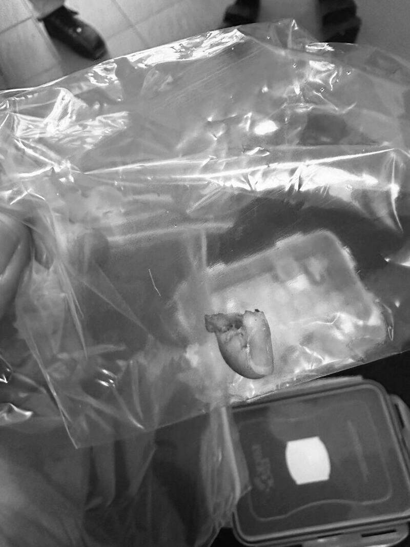 台东市丰荣里长施皓轩捡拾路边断指，放入塑胶袋冷藏，随后由警方取走。（施皓轩提供）(photo:LTN)