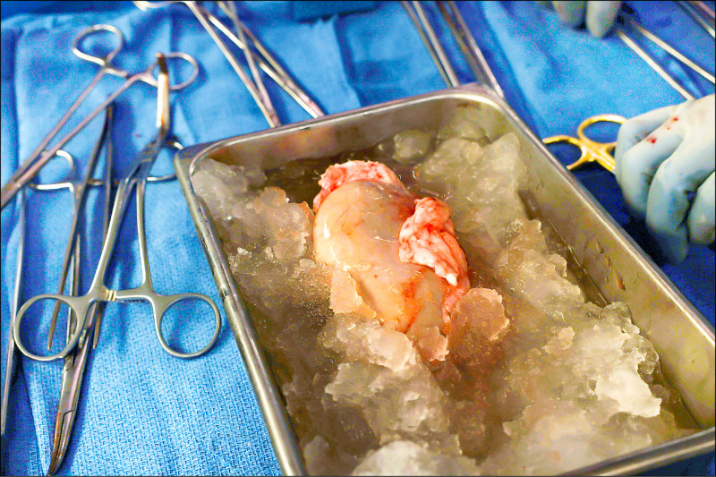 美国麻州综合医院21日宣佈，成功将取自基因改造猪只的肾脏，移植到一名病患身上，创世界首例。（美联社）(photo:LTN)