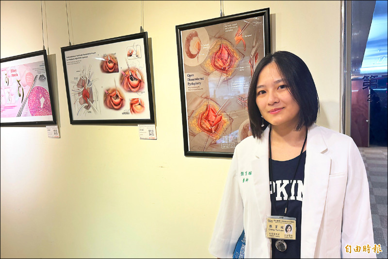 張育瑄說,國內醫療水準高,新技術不斷推陳出新,發展本土醫學繪圖更顯重要。 (記者邱芷柔攝) 張育瑄說,國內醫療水準高,新技術不斷推陳出新,發展本土醫學繪圖更顯重要。 (記者邱芷柔攝)