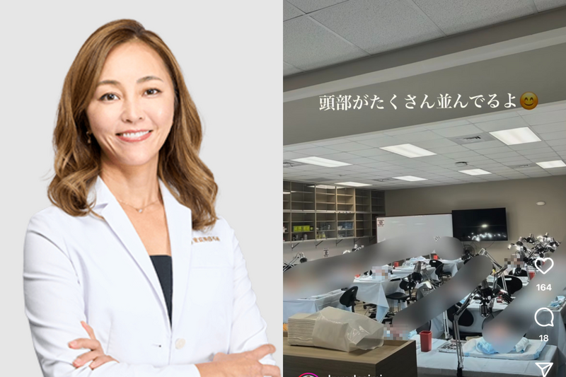 日本白目美容外科院長PO大體老師解剖照 頭顱未打碼挨批醫德淪喪