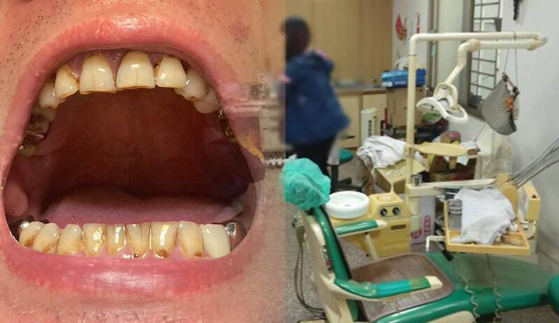 國中畢業印尼籍孕媽無照開業當牙醫 還開臉書及抖音吸客 - 社會 - 自由時報電子報