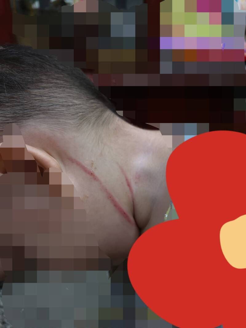 [討論] 台中又爆發虐童案!!