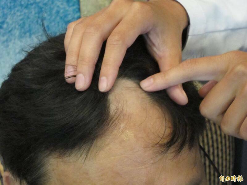 [圖]