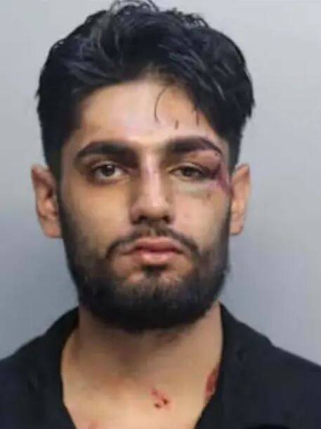 男子被打成臉部腫脹與擦傷。（圖取自Miami‑Dade拘留中心）