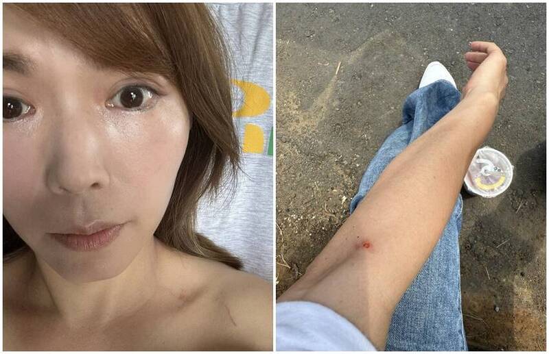 民眾黨走讀闖禁區挨轟！陳智菡PO「抓痕」反控警施暴 嗆：要辦就來