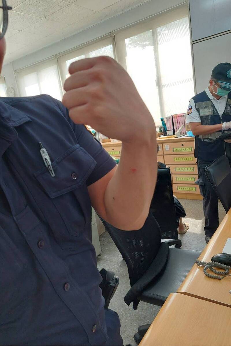 網控女子遭打重傷 岡山警澄清：掛偽造車牌拒盤查自傷還襲警