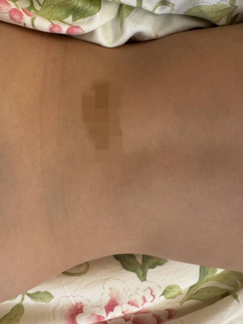 新竹市香山某私幼爆虐童，案件越滚越烈，已有10多名家长报警，且涉案教师不只1人，家长也组群组，准备集体诉讼要真相。（读者提供）
