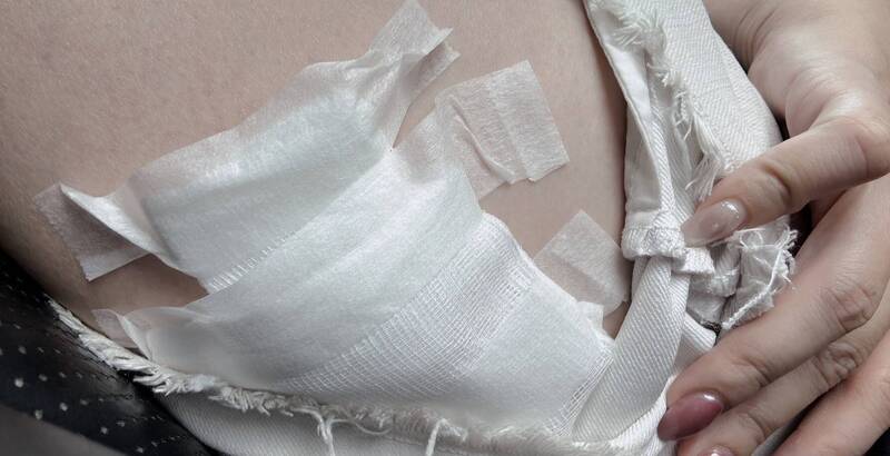 台南和順工業區流浪狗頻傳咬人 又有廠商被「黑老大」咬傷