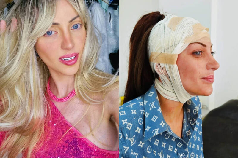 整形27次為成芭比夢!巴西女網紅驚傳「半裸陳屍」51歲男家中