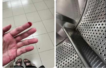 女子自助洗衣店拿內衣遭刀片割傷 先尋求消保官協調