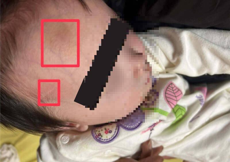 新北1歲童送安置機構疑受虐 警依兒少法傳訊相關人