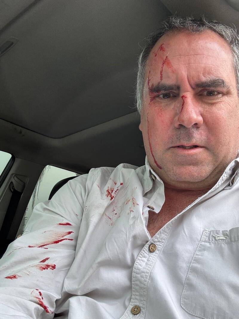 秘魯總統參選人駕車遇槍擊受傷 開12槍反擊歹徒