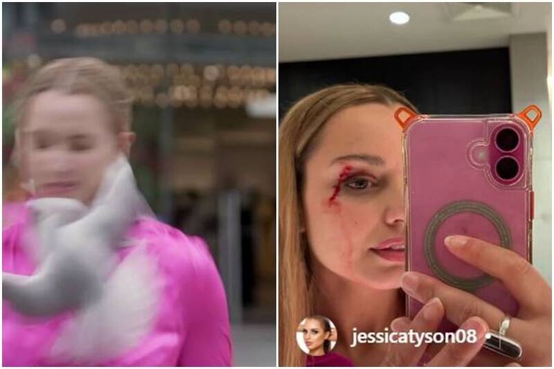 女記者播報遭海鷗直衝「閃巴掌」 下秒眼角濺血驚悚畫面全被拍