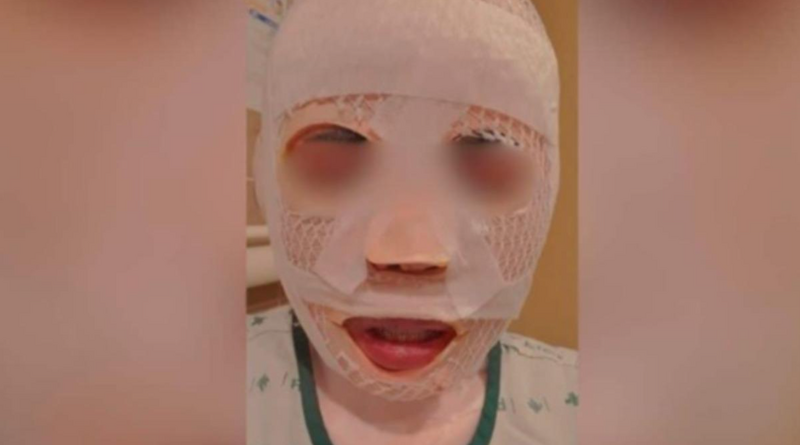 恐怖韓男妒火攻心 朝熟睡妻潑滾水:變醜就不會離開我!