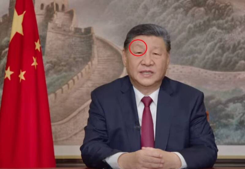 習近平右臉眉骨出現凸起。（取自微博）