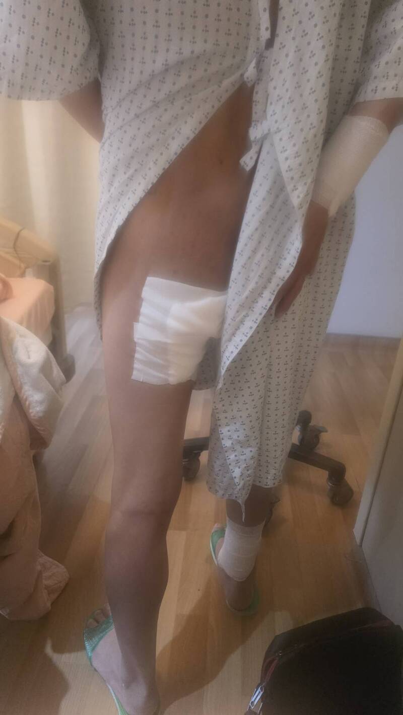 開車加油遇怪男自焚全身火撲過來 保全來不及跑多處灼傷將提告殺人