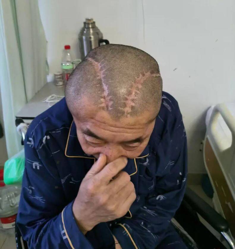 「蒙古大夫」左右不分！男子右腦出血被開左腦術後癱瘓3年