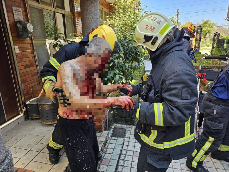 身體多處被炸傷的洪姓男子。（民眾提供）