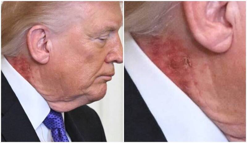 健康亮紅燈?川普被拍到脖子「怪怪的」 白宮御醫全說了!