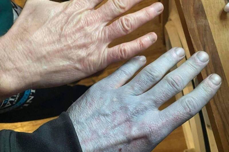 英男睡醒變《阿凡達》驚動10醫師!結果神翻轉醫護全愣住