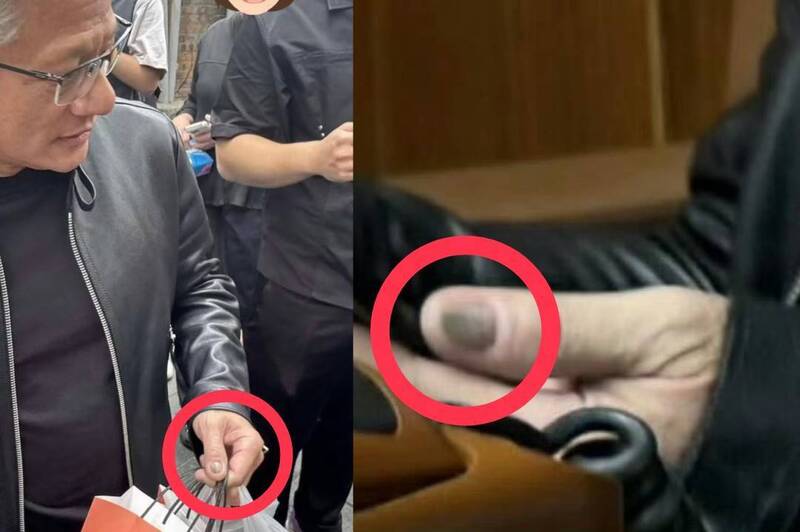 黃仁勳「灰色指甲」吸210萬人關注!皮膚科醫師看照揭真相