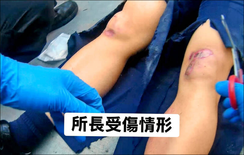 彰化縣施姓男子拒查倒車逃逸，埔鹽分駐所所長陳國銘遭車輾過，右腳膝蓋骨裂、小腿骨折。（民眾提供）