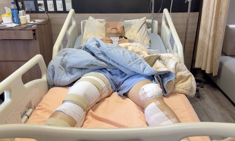 毒駕撞警男逍遙9天終收押 斷腿所長一句話令人心疼