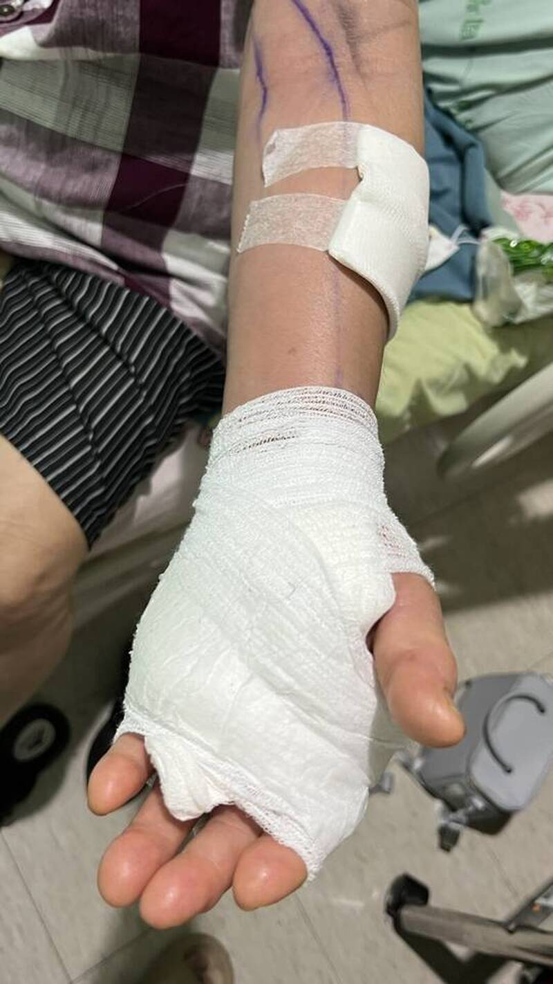 處理吳郭魚遭魚鰭刺傷!雲林婦感染海洋弧菌 若延遲就醫恐截肢