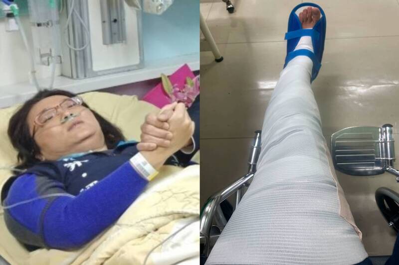 這次不是夾到手! 陳玉珍突曬「左腿打石膏」 自曝受傷原因