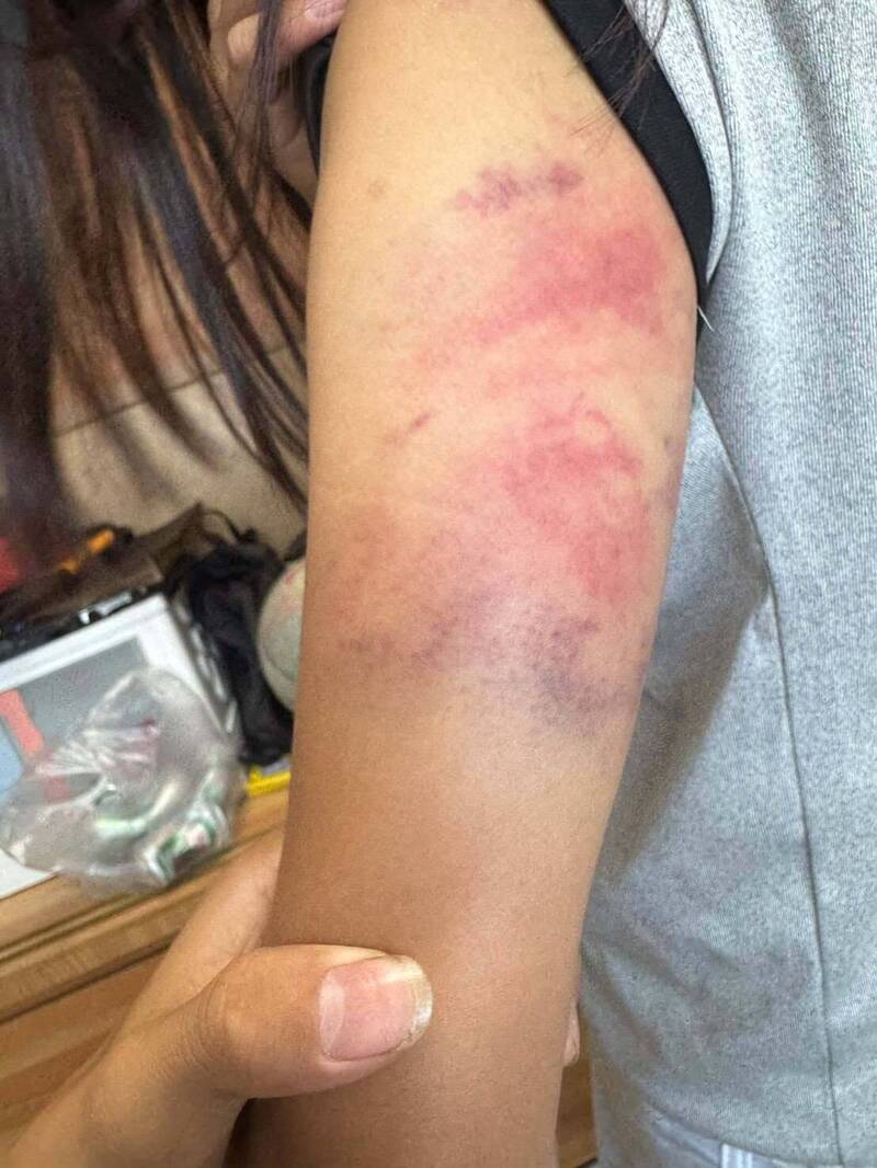 桃園少女控遭父長期家暴 深夜逃往同學家求助