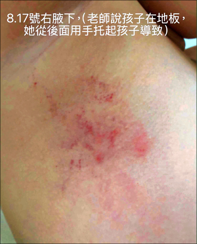 台中又傳虐童 通報3天教育局才調查