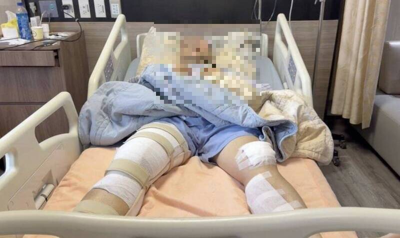 毒駕超標7倍撞警!埔鹽所長遭輾斷腿 抱憾缺席女兒婚禮