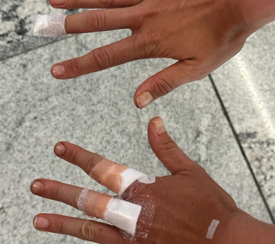 P:2:網球》飯店淋浴間的門突爆裂 巴西女將衰遇血光之災遺憾退賽