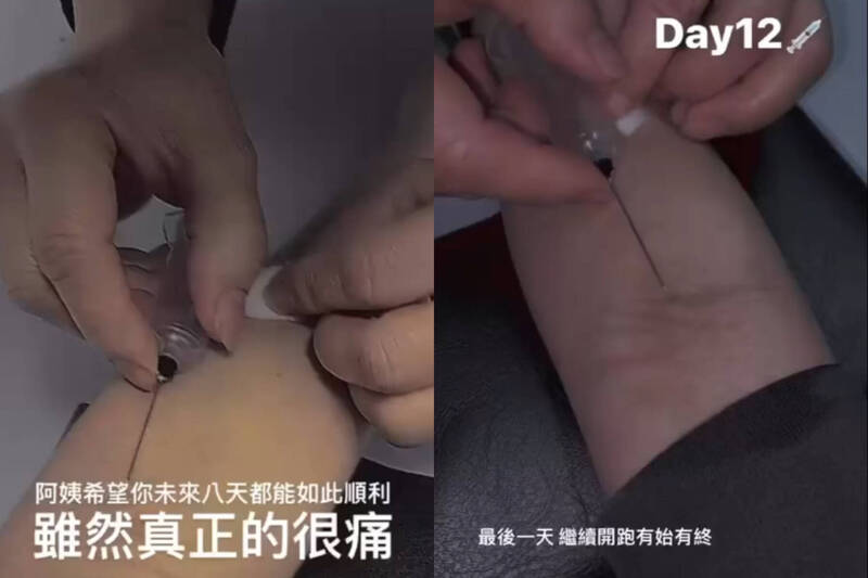心疼！台師大女足球員曝光12天抽血紀錄 發燒掛急診被逼繼續實驗