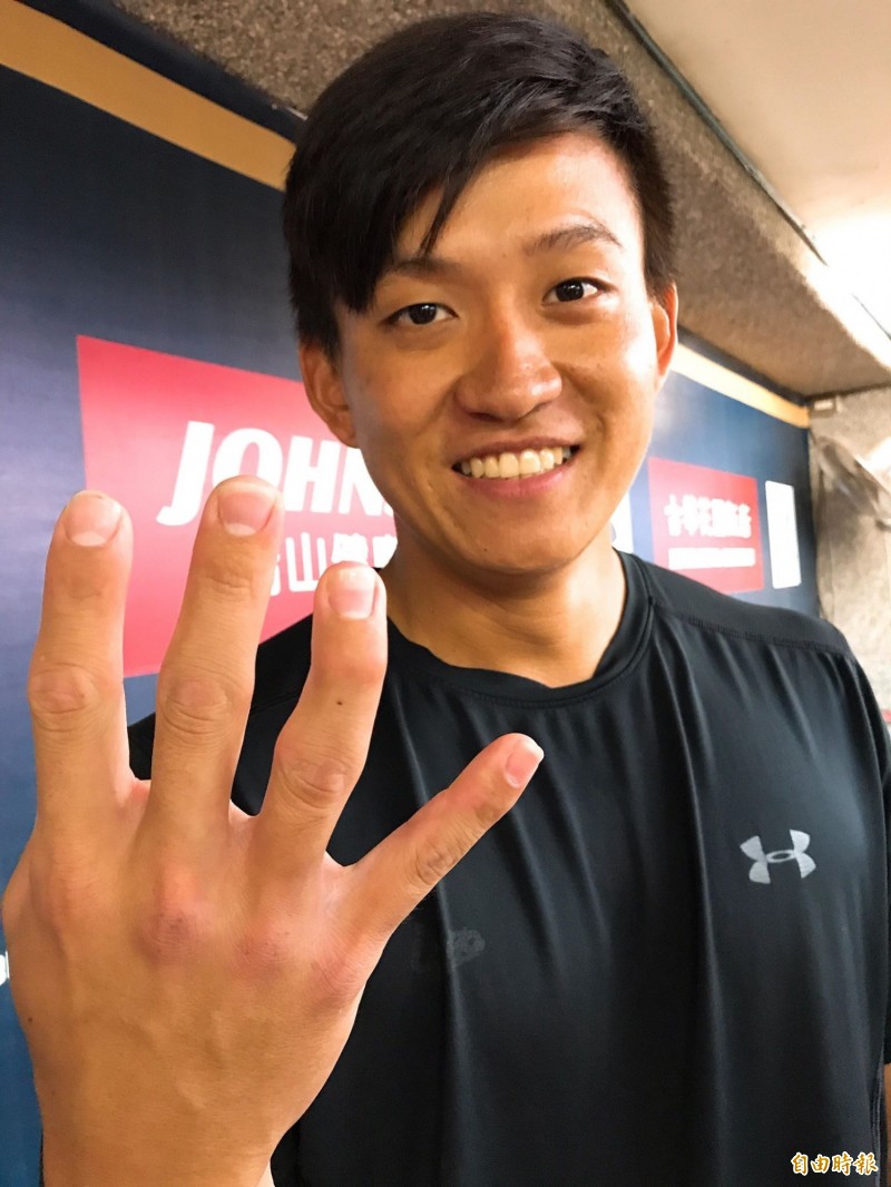 張閔勛傷勢雖然痊癒，右手無名指卻已經變形。（記者徐正揚攝）