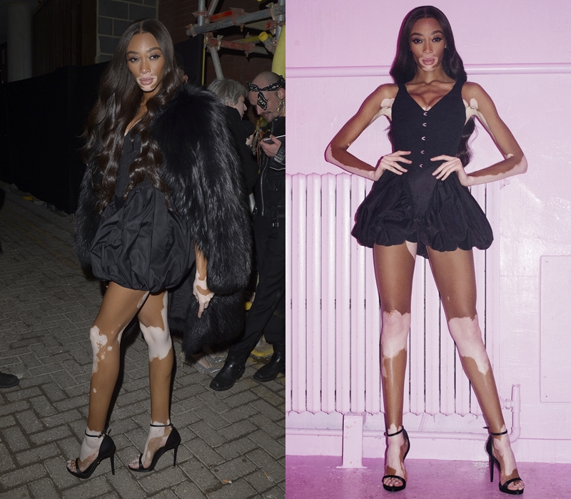 白斑女模 Winnie Harlow。