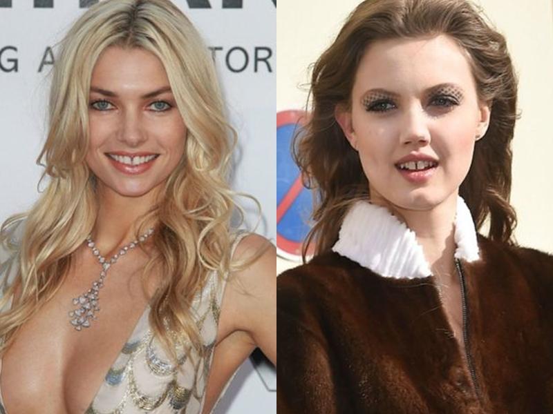 左：Jessica Hart、右：Lindsey Wixson。