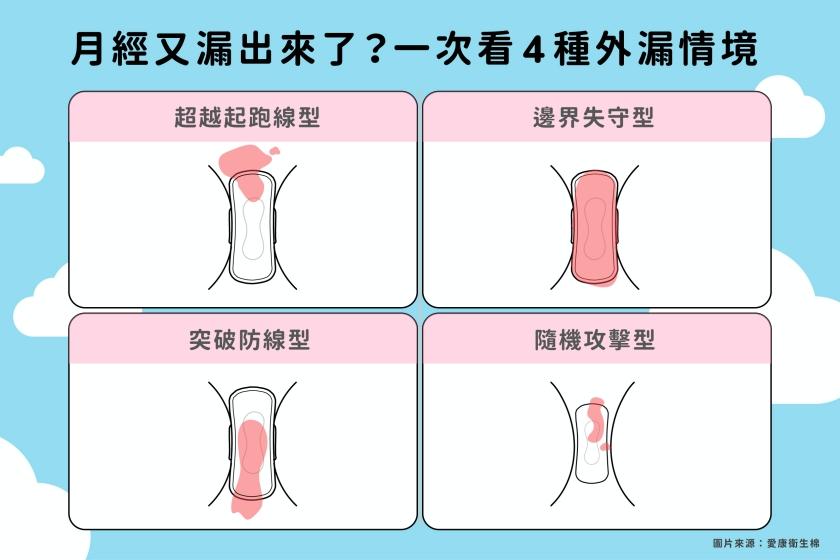 愛康整理女生最常面臨的4種外漏情境。