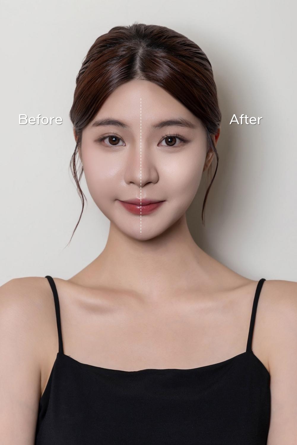 透過遮瑕的「線雕拉提修容術」，畫出幼態臉。