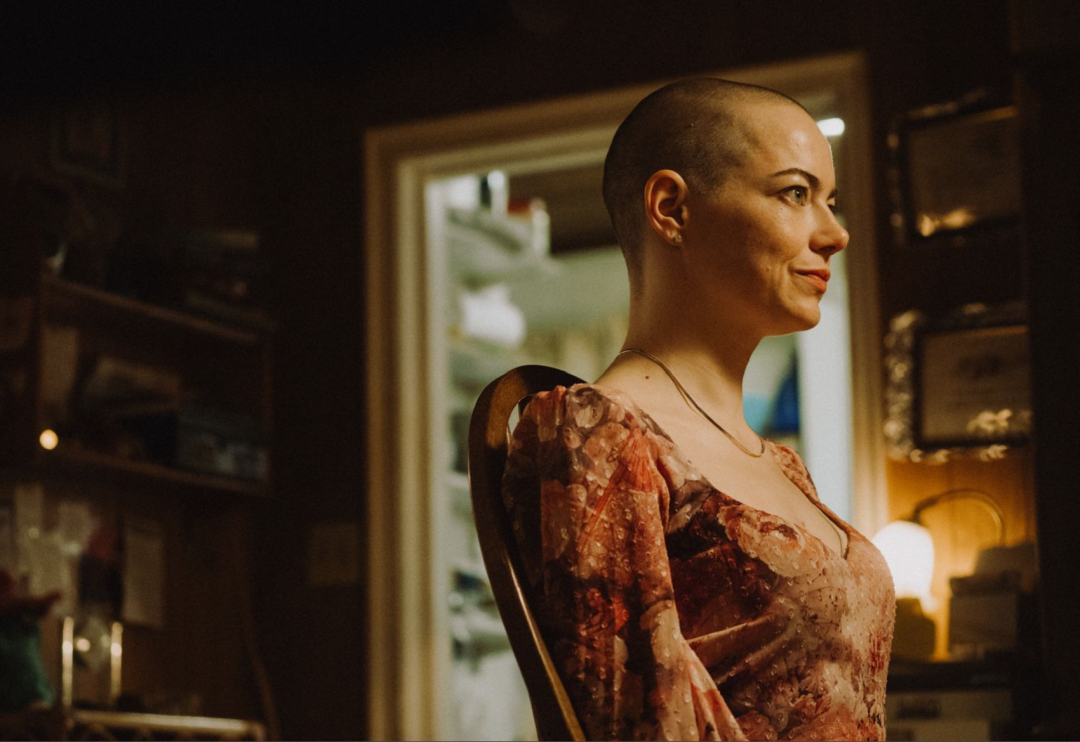 艾瑪史東的光頭造型嚇壞粉絲。(翻攝自IG)