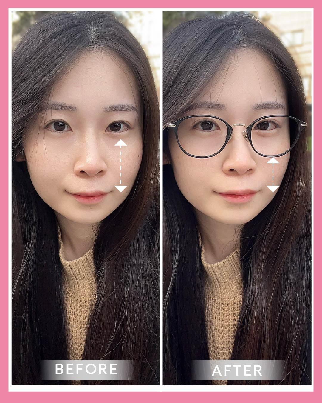 下眼瞼到上脣之間的「中庭」區域，與臉部比例與成熟度有直接相關，中庭較長，臉看起來偏長，顯得成熟。縮短中庭，臉部重心自然下移，能不著痕跡變成巴掌臉。