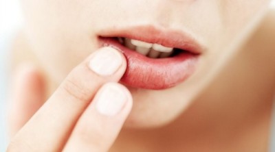 醫療新知與日常保健》天乾物燥，嘴唇發炎怎麼辦？