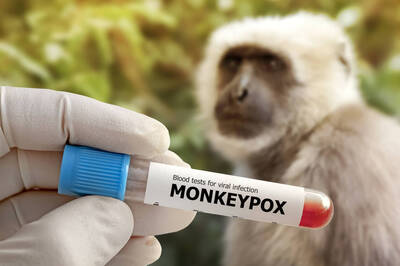 研之有物》該繼續擔心猴痘嗎？解密痘病毒進入細胞的機制